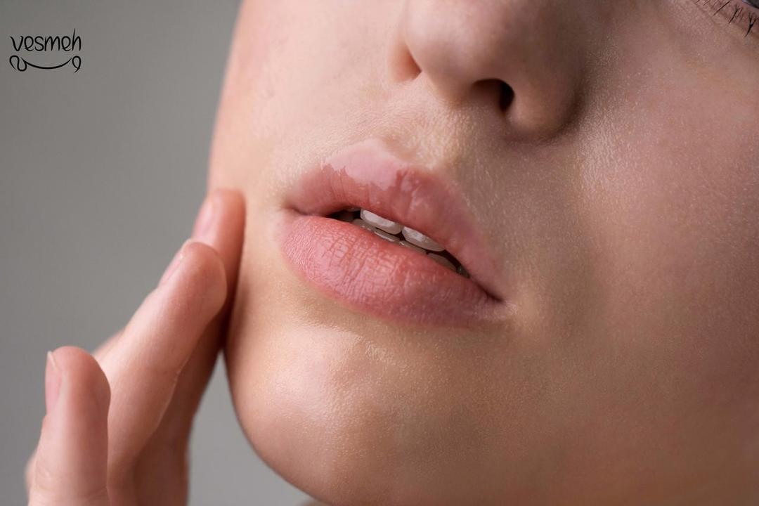 چرا لبها خشک و پوستهپوسته میشوند؟ دلایل و روشهای پیشگیری از خشکی لب